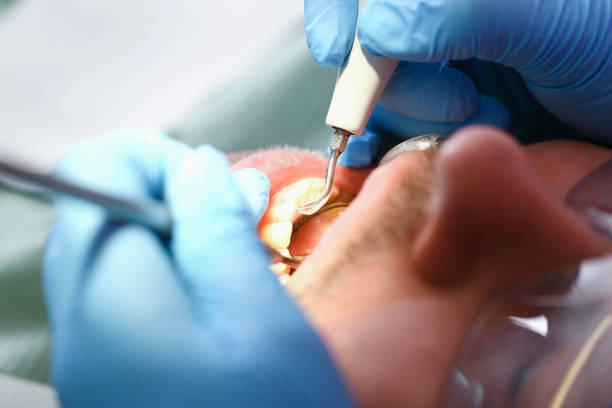 Best Emergency Treatment for Toothache in Aransas Pass, TX